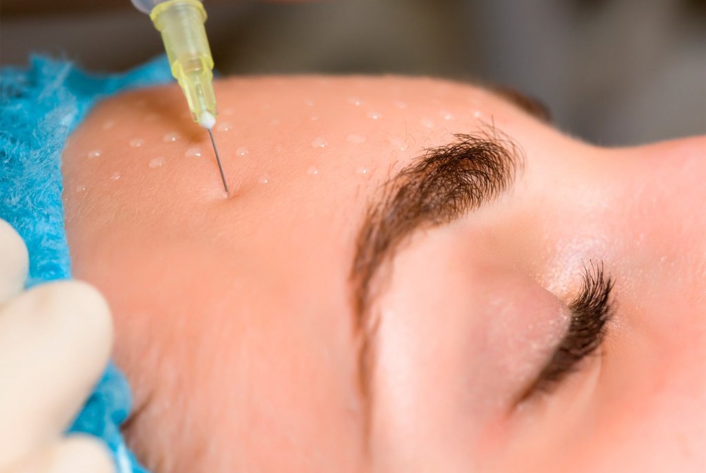Le traitement de skinbooster au Luxembourg